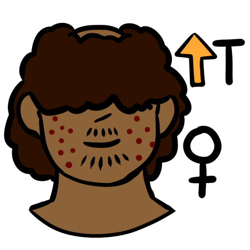 a person with brown skin tone. They have acne, facial hair, and a bald spot on the top of their head. They have dark brown curly hair. In the upper left of the image is an orange up arrow next to the letter T. In the bottom left is a female symbol.